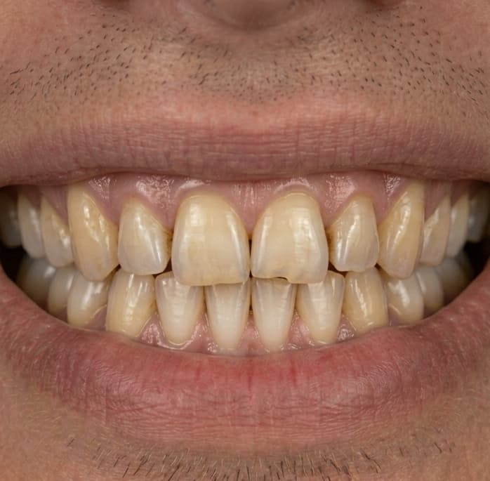 Antes: Rehabilitación estética integral